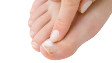 How Effective Is Hydrogen Peroxide For Toenail Fungus?