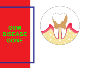 Gum Disease Gone reviews