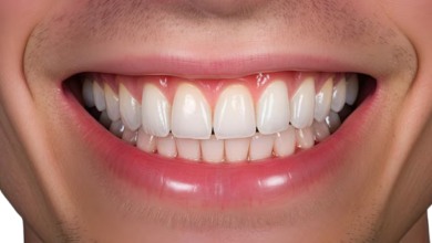 How To Reduce Gap Between Teeth Naturally At Home