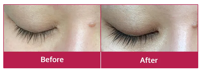 Miracle Lash Benefits